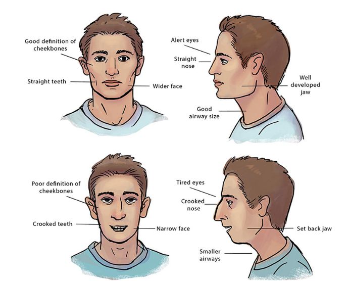 The difference between a normal person and someone with tongue-tie