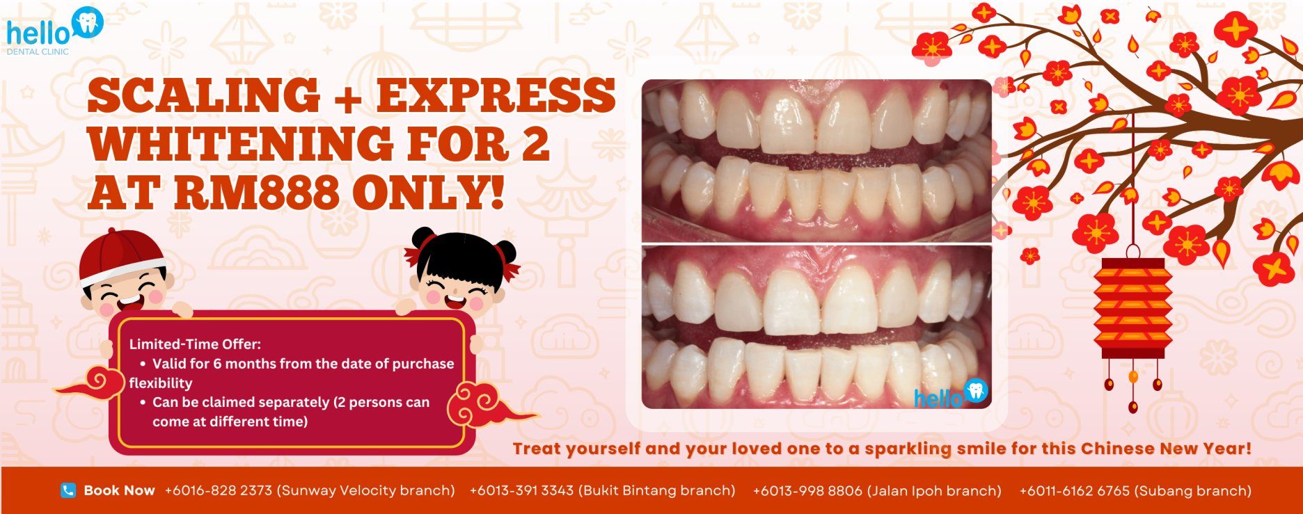 Scalling + Express Whitening